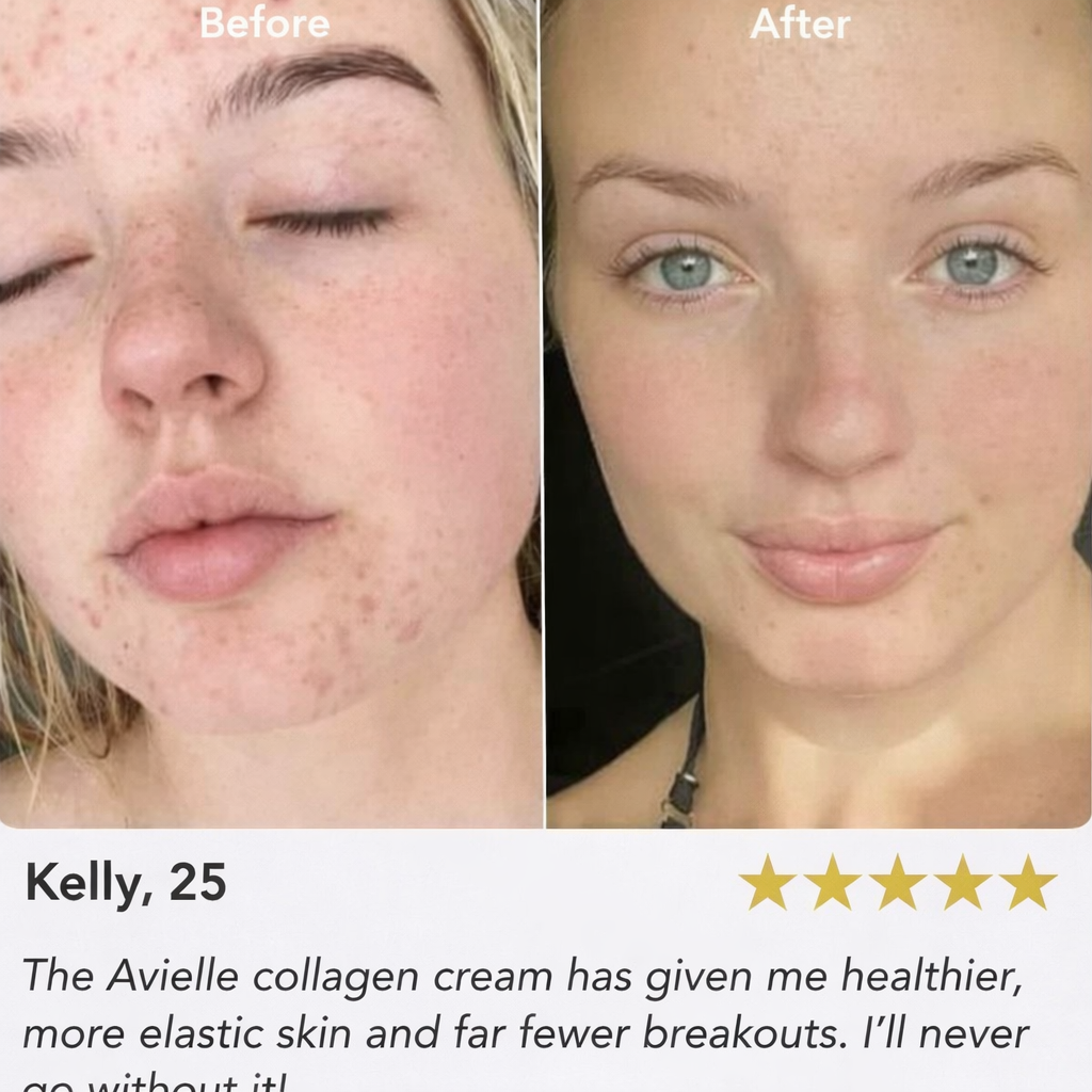 Avielle™ Anti-Aging Collagen Jelly Cream
