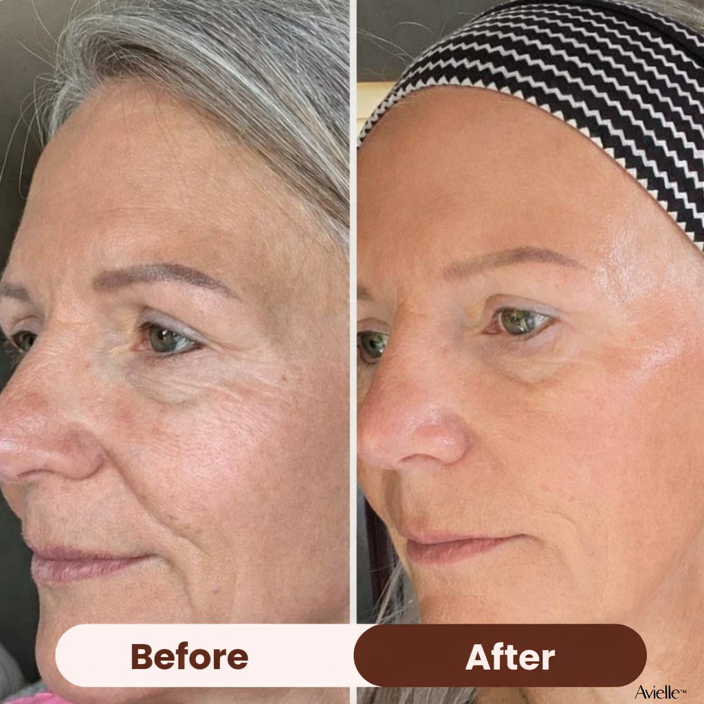 Avielle™ Bio-Collagen Mask